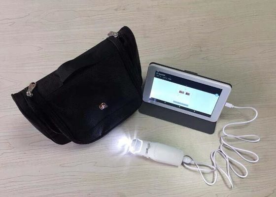 PAL Color System AV Signal Digital Electronic Colposcope With TF Card And Monitor