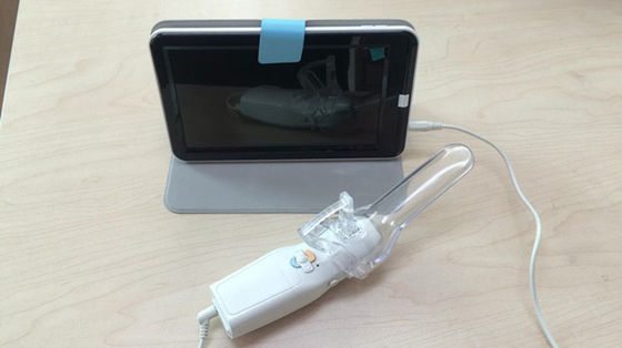 Vaginal Camera for Women Care Digital Mini Colposcope 1.5 Times Magnification 10cm Observation Distance