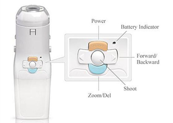 Healthcare Product Gynecological Endoscopic Digital Electronic Colposcope For Women Home Use