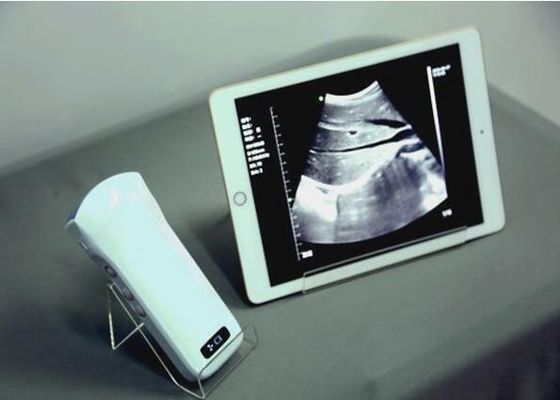 Windows Pocket Ultrasound Scanner Machines Electronic Phased Array