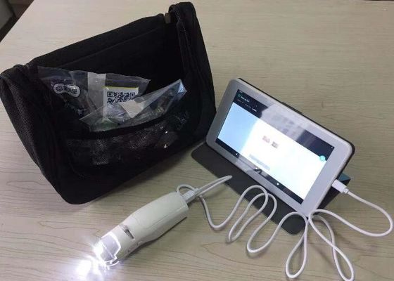 High Definition Display AV / USB Output Vaginal Probe Digital Electronic Colposcope