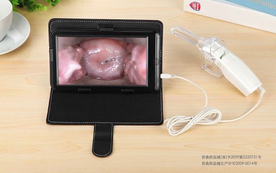 High Definition Display AV / USB Output Vaginal Probe Digital Electronic Colposcope
