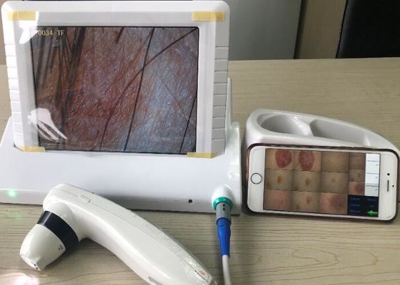Digital Portable Skin Moisture Analyzer With APP Downloaded To Mobilephone